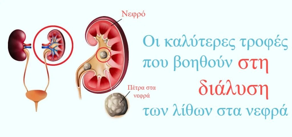 Οι καλύτερες τροφές που βοηθούν στη διάλυση των λίθων στα νεφρά